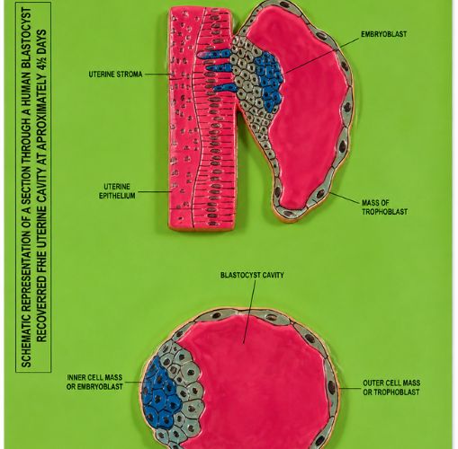 3D Human Blastocyst Implantation Model